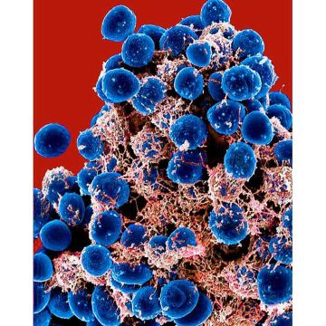 Scanning electron micrograph of clump of Staphylococcus epidermidis bacteria in extracellular matrix, which connects cells and